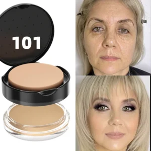 101